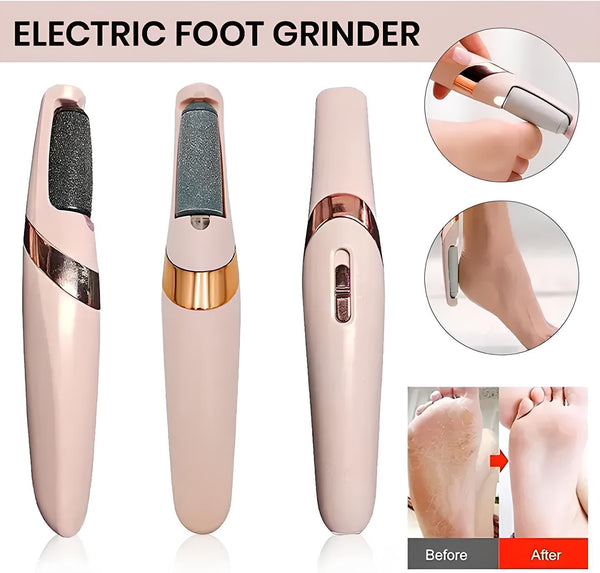 Electric Foot File Callus Remover
